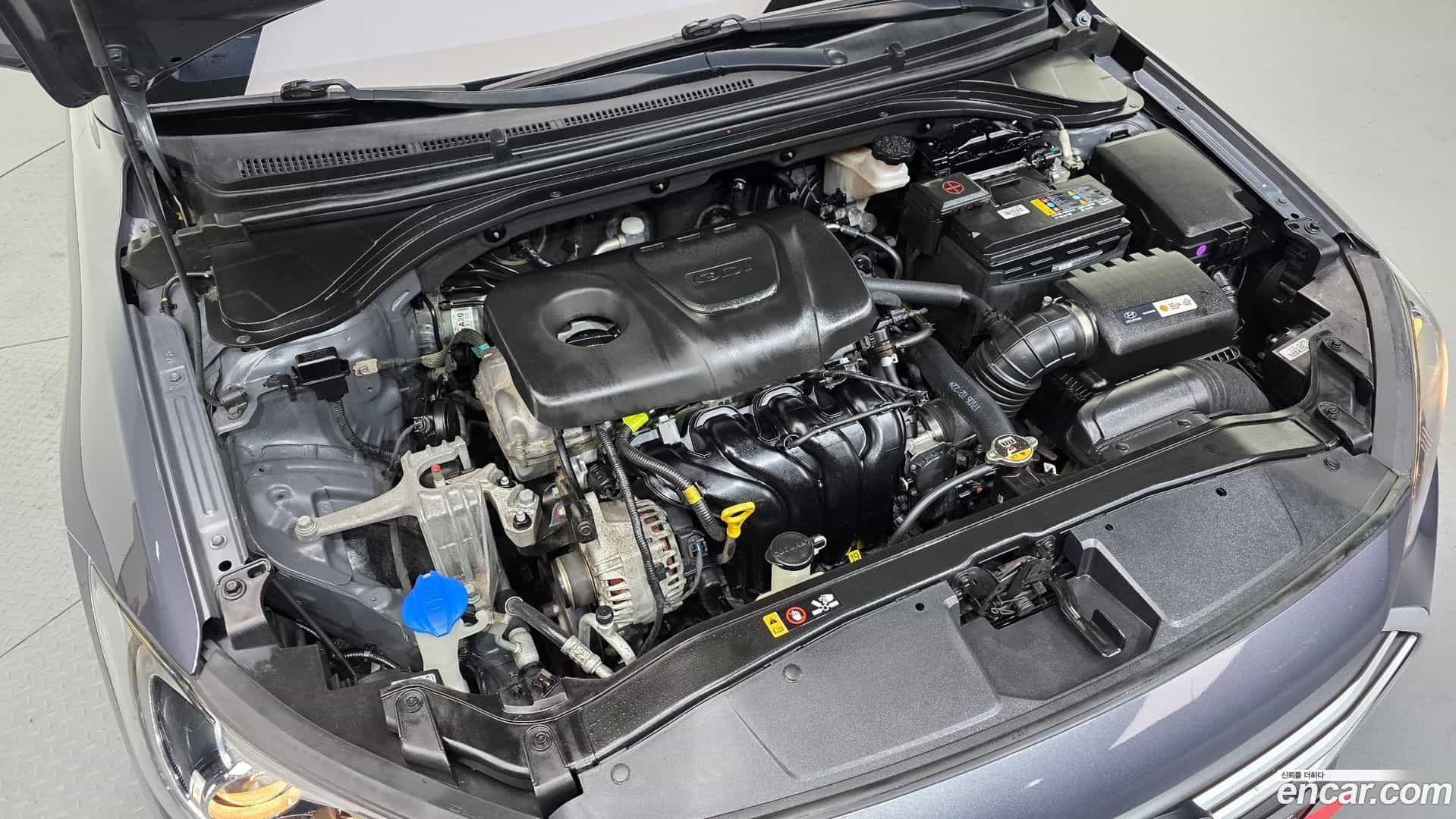AVANTE Hyundai 2017.10-OUTER-006